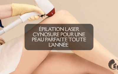 Épilation laser Cynosure pour une peau parfaite toute l’année